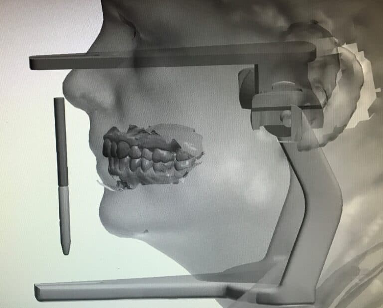 3D-Gesichtsmodell mit Artikulator-Bezug in der Seitenansicht